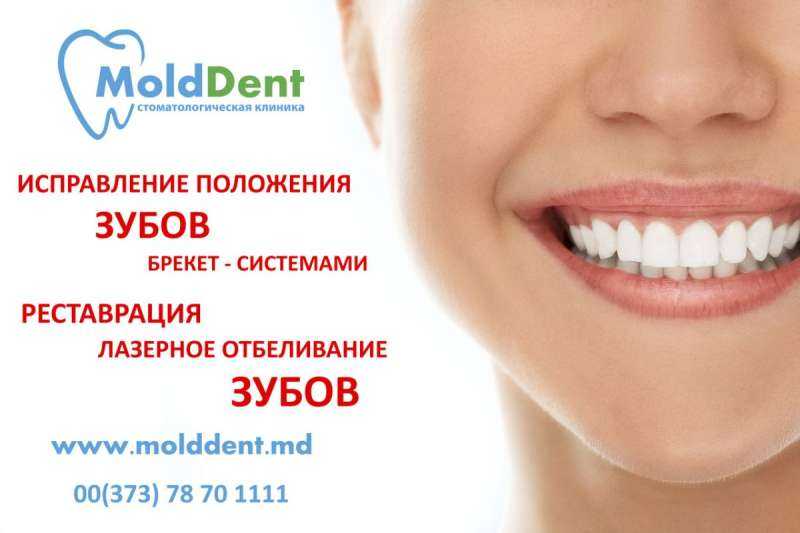 Реклама брекетов в стоматологии